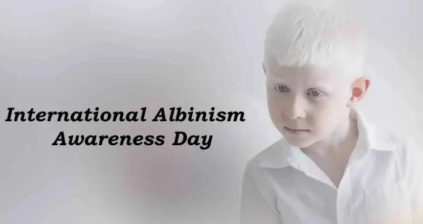 International Albinism Awareness Day